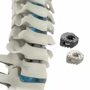 Cervical-Cage-ALIF